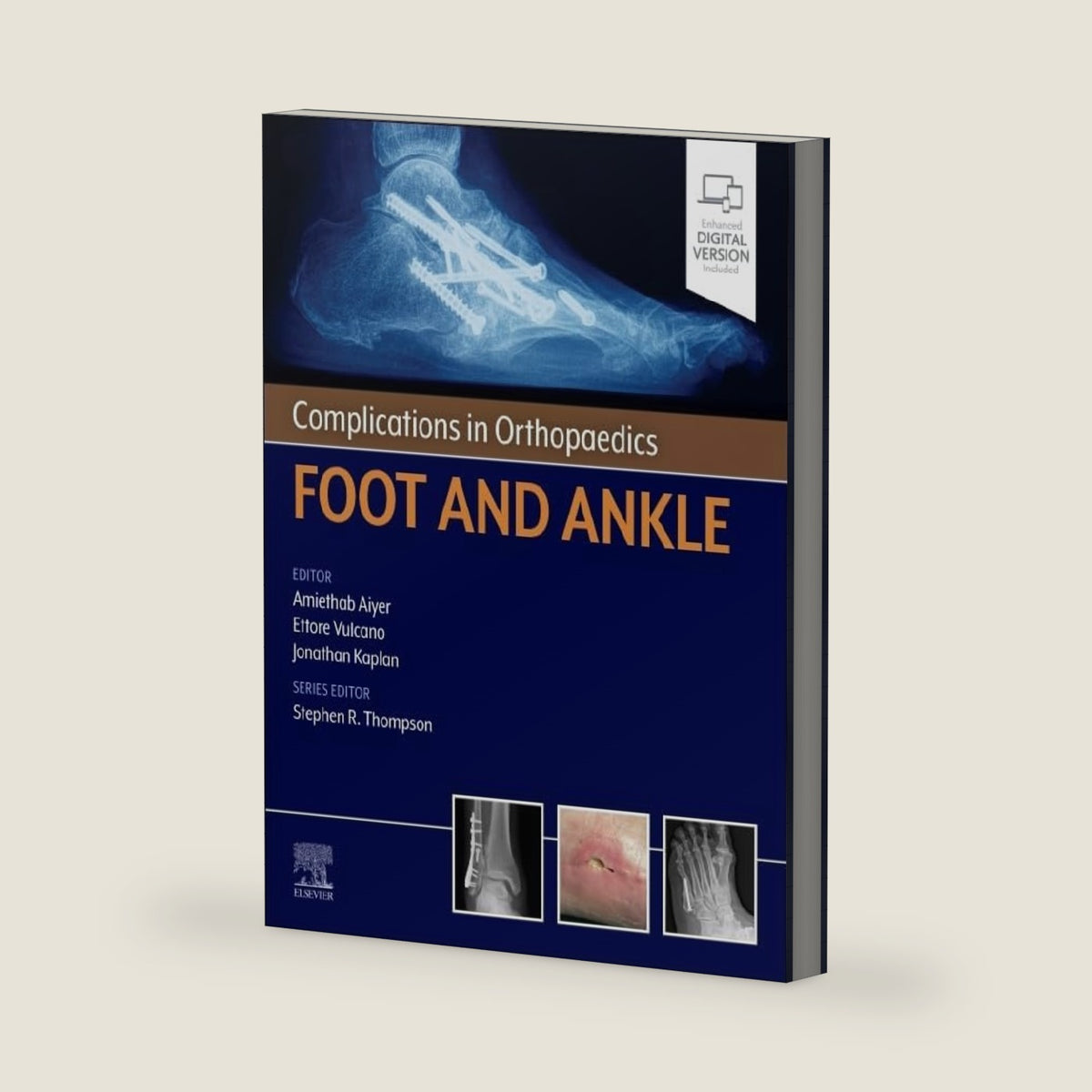 Complications in Orthopaedics: Foot and Ankle by Amiethab Aiyer MD FAOA FAAOS