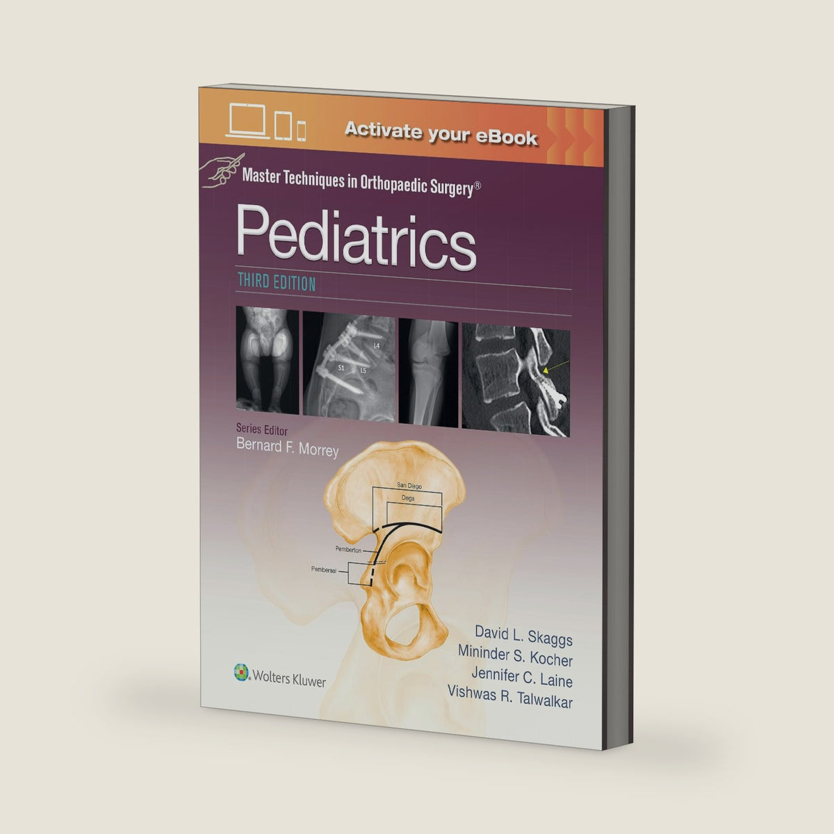 Master Techniques in Orthopaedic Surgery: Pediatrics Print + eBook with Multimedia by DAVID L. SKAGGS